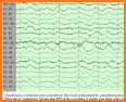 EEG Tutorial related image