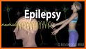 Epilepsy related image