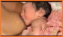 Engorgement allaitement, Child breastfeeding related image