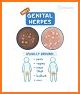 STD Dating for Herpes, Hiv, Hpv, Hsv, Hepatitis related image