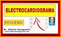 Electrocardiograma ECG Tipos related image