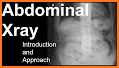 Easy Abdominal X-Ray related image