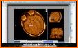 Dicom Medical Image Viewer related image