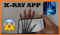 Xray Body Scanner- Mobile Game related image