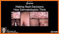 Dermatology DDx related image