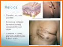 ABC Dermatology for Nurses and Medical Students related image