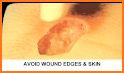 Wound Care Physician Notes related image
