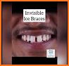 Dentist & Braces doctor - Mouth care surgery related image