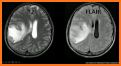 Magnetic Resonance Imaging Sequences related image