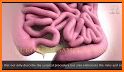 SurgTalk - Animated Videos for Patient Education related image