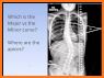 Radiology Measurements related image