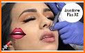 Botox Cam - Botox Lips Shape & Body Shape related image