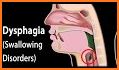 Dysphagia Therapy related image