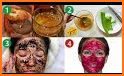 Easy and Effective Home Remedies related image