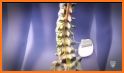 Spinal Intervention Pain Manag related image