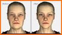 Botox Clinic 3D related image