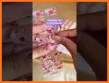 WiNiT related image
