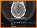 KMHS Aware related image