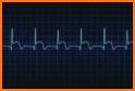 EKG Electrocardiography Exam review  Free App related image