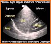 Ultrasound GUIDE - Free Library related image