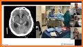 Mount Sinai Guides: Neurology related image