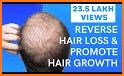 Hair fall control and growth related image