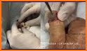 Baby Surgery Emergency Operation Thigh Specialist related image