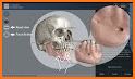 3D Skull Atlas related image