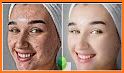 Pimple Remover Photo Editor related image