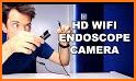 Endoscope Camera View related image