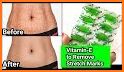 Get rid of STRETCH MARKS - Home Remedies related image