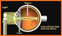 GlassesOn  |  Lenses & Pupils related image