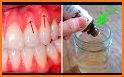 Home Remedies - Natural Cures for Common Problems related image