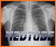 Easy Chest X-Ray related image