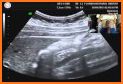 FULL ULTRASOUND GUIDE related image