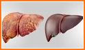 Liver Health related image