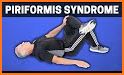 Piriformis syndrome related image