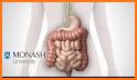 Zemedy - IBS, Gut Relief (CBT, Poop,Tracker, Diet) related image