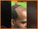 Hairlines related image