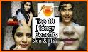 Benefits Of Using Honey For Face & Skin related image