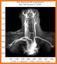 UBC Radiology related image