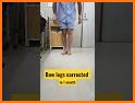 Bendy Legs related image