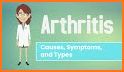 Arthritis: Causes, Diagnosis, and Treatment related image