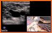 Ultrasound GUIDE - Free Library related image