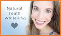 Whiten Teeth Naturally related image
