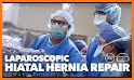 360 Hernia related image
