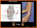 Orthopedic Anatomy related image