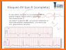 Electrocardiograma ECG Tipos related image