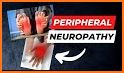 Peripheral Nerve Expert related image