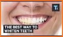 Whiten teeth naturally related image